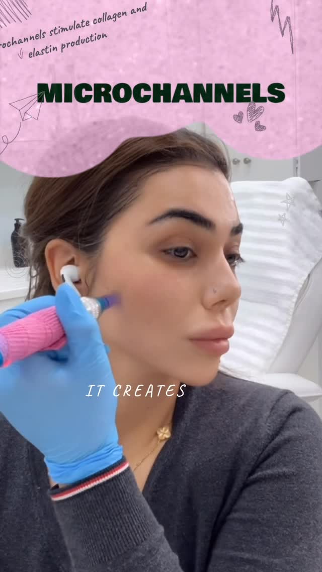 Skin needling, the why and the how