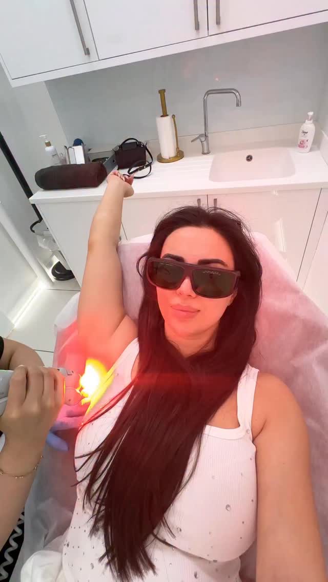 Summer skin laser session in progress