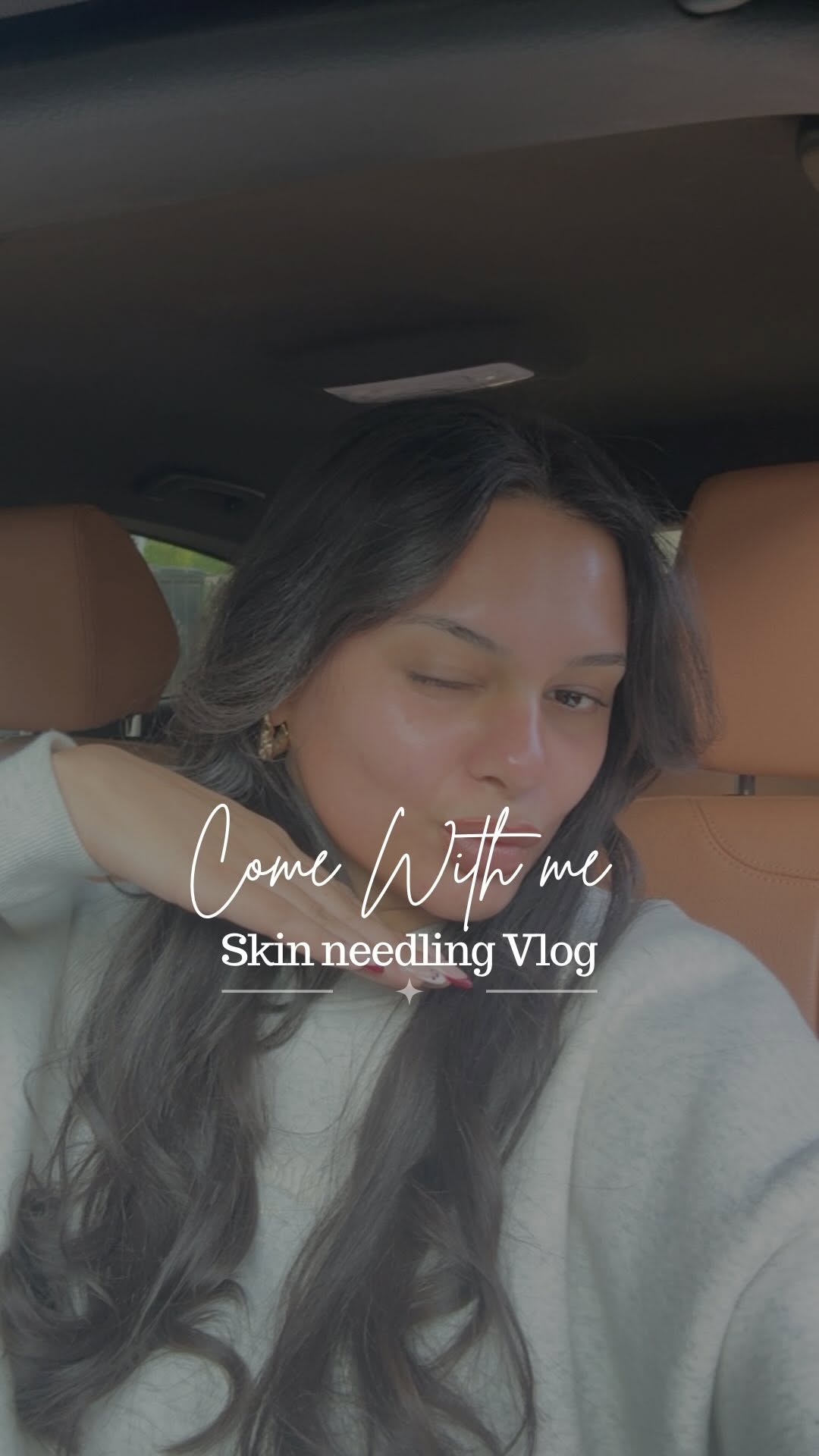 A client's first skin needling visit
