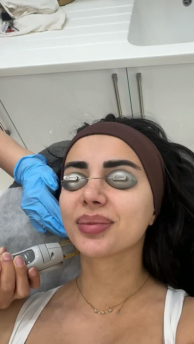 Laser hair removal session at Dalya Cosmo Clinic